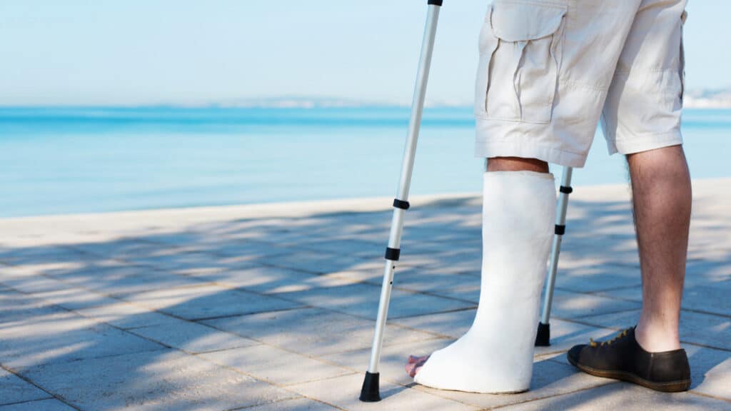 Mann mit einem Gipsverband am Bein, der eine Krücke benutzt, steht am Strand mit Blick auf das Wasser.